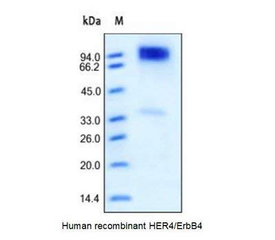 7401-50 - Размер: 50 микрограма - Човешката клетка ErbB4/HER4, рекомбинантная човешката - Всяка (50 микрограма)